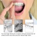 Nice Orthodontic Aligner Remove Invisible Removable Braces Clear Aligner Removal Tool Plastic